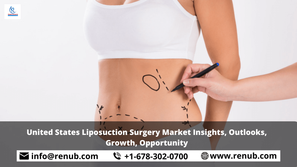United States Liposuction Surgery Market Insights, Outlooks, Growth, Opportunity