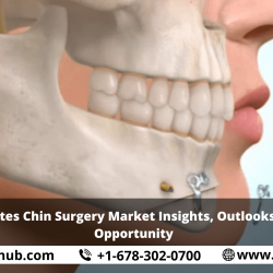United States Chin Surgery Market Insights, Outlooks, Growth, Opportunity