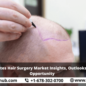 United States Hair Surgery Market Insights, Outlooks, Growth, Opportunity