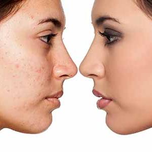 Scar Removal treatment Market Study, Synthesis and Summation 2019-2022