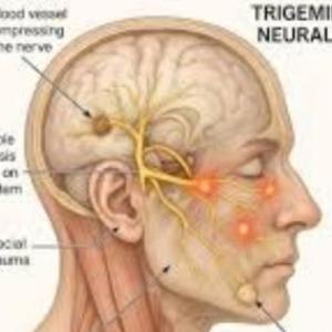 A Patient Journey for Living a Normal Life with Trigeminal Neuralgia