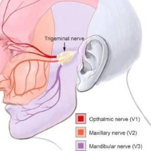 Best Trigeminal Neuralgia Specialist in India: Tips for Living a Normal Life 