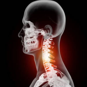 Cervical Spine Injuries: Prevention, Treatment, and Recovery