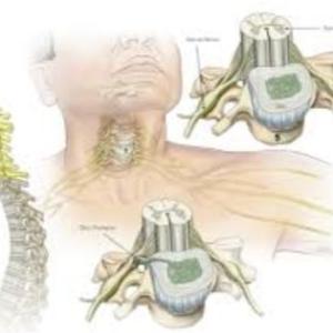 Cervical Spine Neurosurgery in Kolkata: Advanced Solutions for Neck Pain