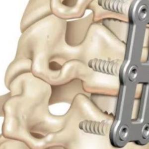 Contact Top Neuro Spine Surgeon in India: Meet the Best Cervical Spine Surgeon