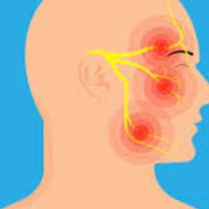 Finding Relief from Trigeminal Neuralgia in India: Expert Treatment Options