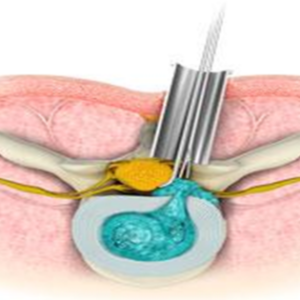 How Minimal Access Spine Surgery in Kolkata Can Improve Spinal Health