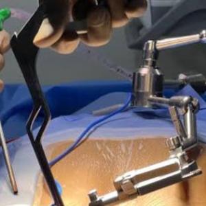 Meet a Top Spine Surgeon in Kolkata – Expert in Minimally Invasive Spine Surgery
