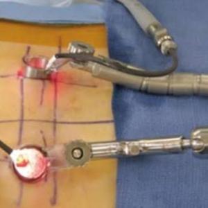 Minimally Invasive Spine Surgery India: Meet the Top Spine Surgeon in Kolkata