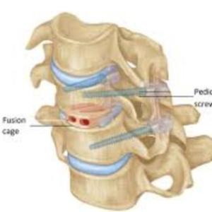The Best Cervical Spine Surgeons in Kolkata: Expertise and Experience You Can Trust