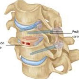 Top Cervical Spine Surgeon in Kolkata: Spine Care & Surgeries