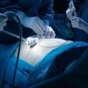 Top Spine Surgeon India: Expert Minimal Access & Minimally Invasive Care