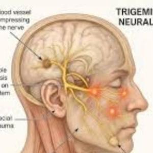 Trigeminal Neuralgia Kolkata: Advanced Interventional Pain Management