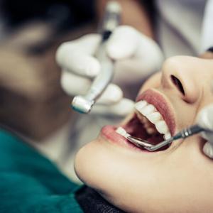 Teeth Polishing vs. Teeth Whitening: How Often Should You Schedule Each in a Year