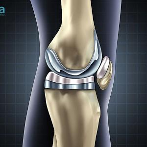 Joint Reconstruction and Joint Replacement - The Difference You Should Know