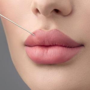The Art of Russian Lip Fillers Treatment in Dubai: What Makes It Unique