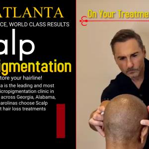 Does Scalp Micropigmentation Work For Long Hair With Receding Hairline?