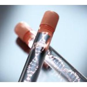 Epigenetics Drugs And Diagnostic Technologies Market