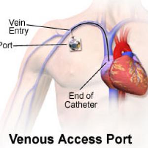 Totally Implantable Access Port Market