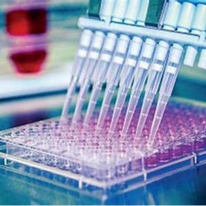 Viral Vector Manufacturing Services Market