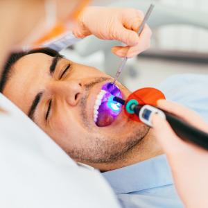 Cavities causes and how a dentist can help