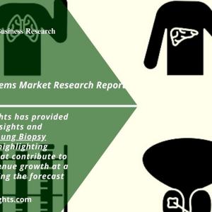 Lung Biopsy Systems Market forecasting the industry's future, News Analysis Report